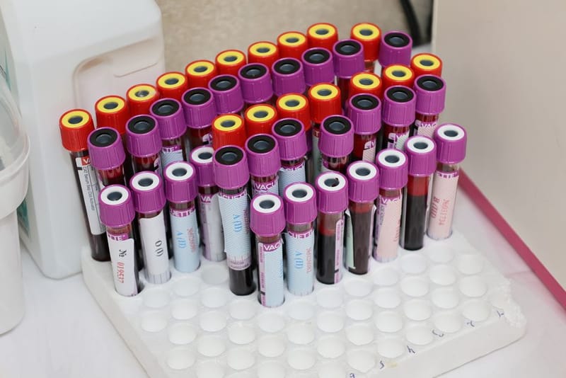 Smart Ring vs Blood Test Biomarkers UK 2026