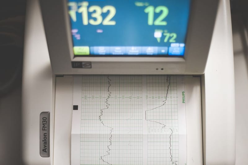 Can a Smart Ring Do an ECG? (2026 Answer)